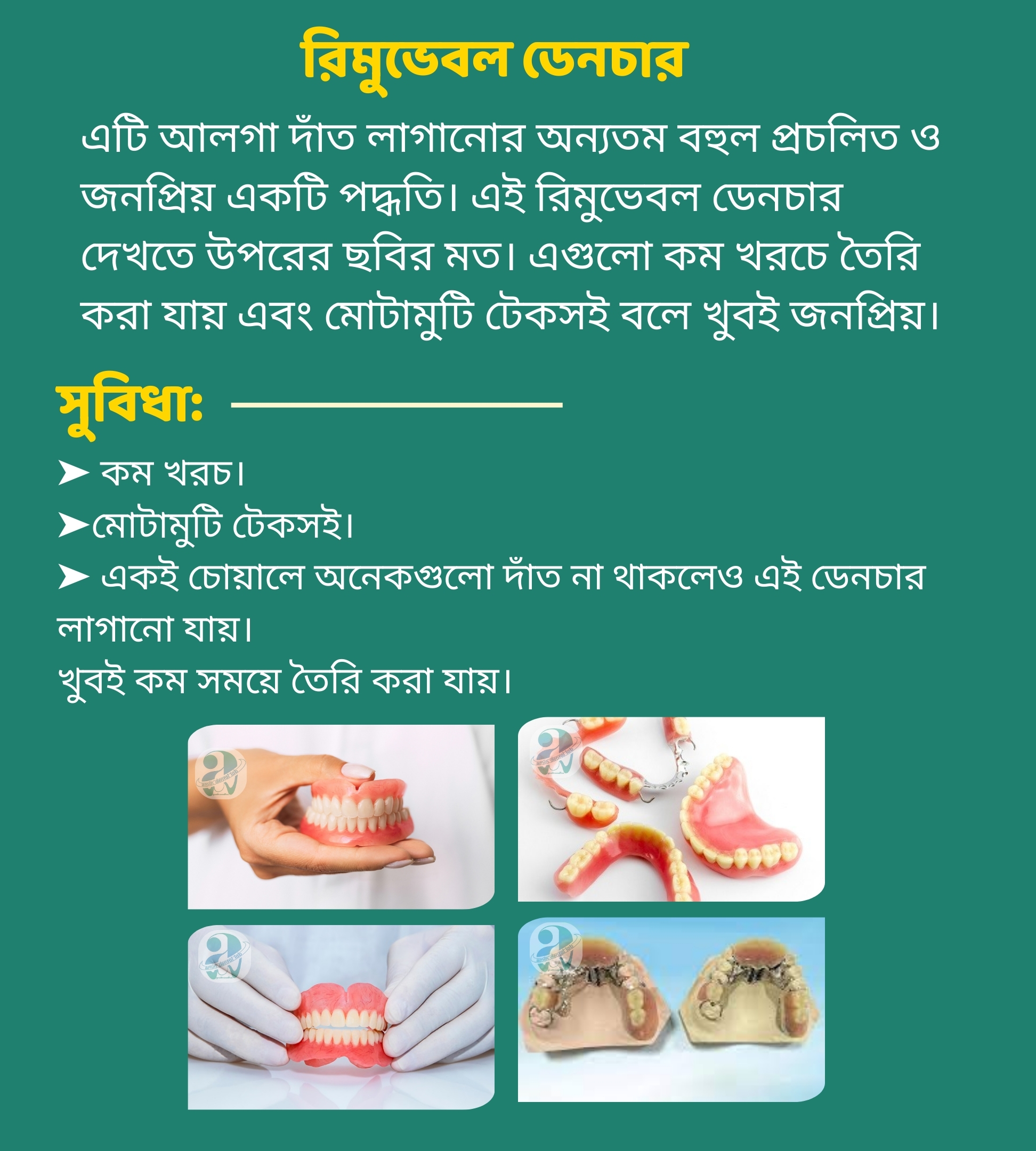 রিমুভেবল ডেনচার